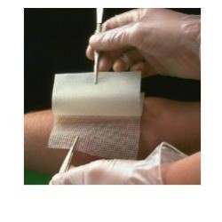 Smith & Nephew Garza...