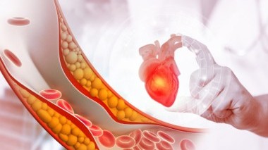 Trigliceridi alti: cosa bisogna fare?